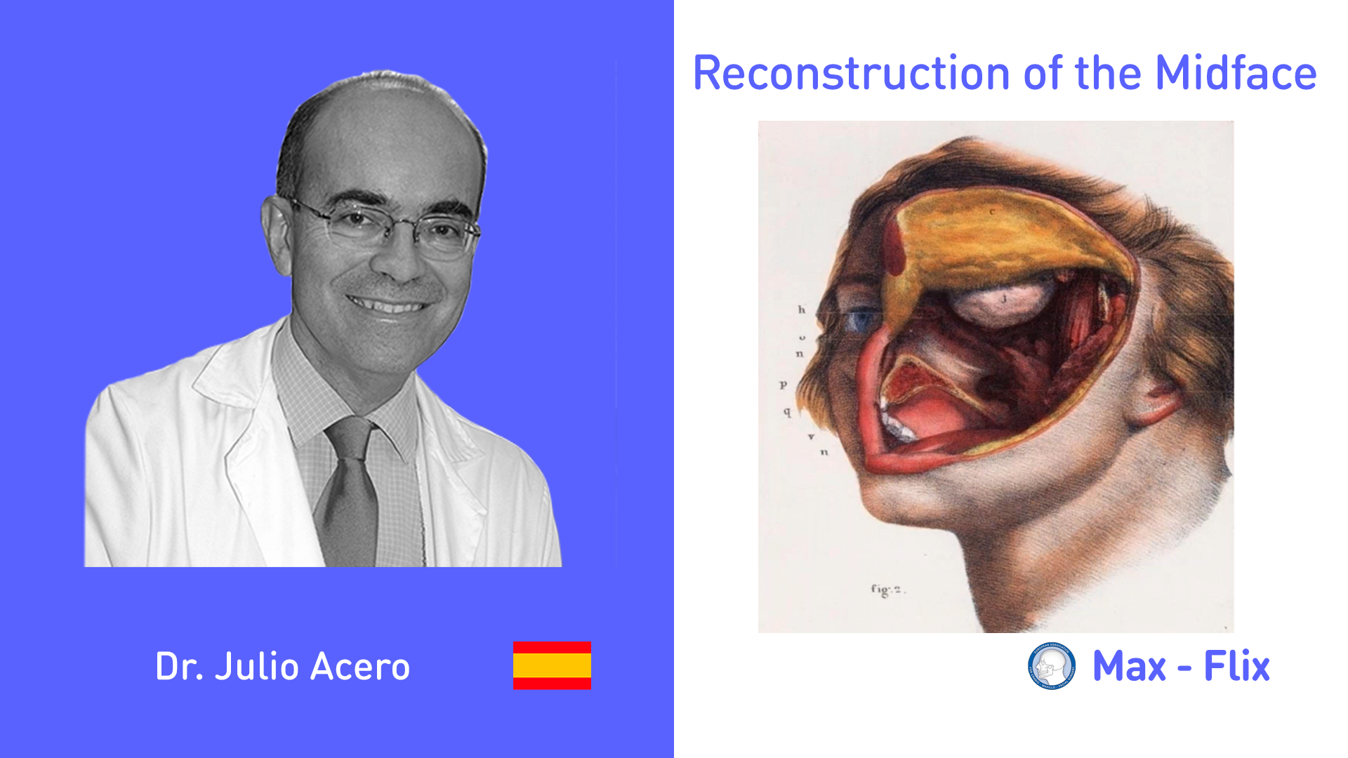 Reconstruction of the Midface – Prof Julio Acero