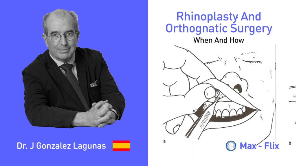 Rhinoplasty and orthognathic surgery when and how