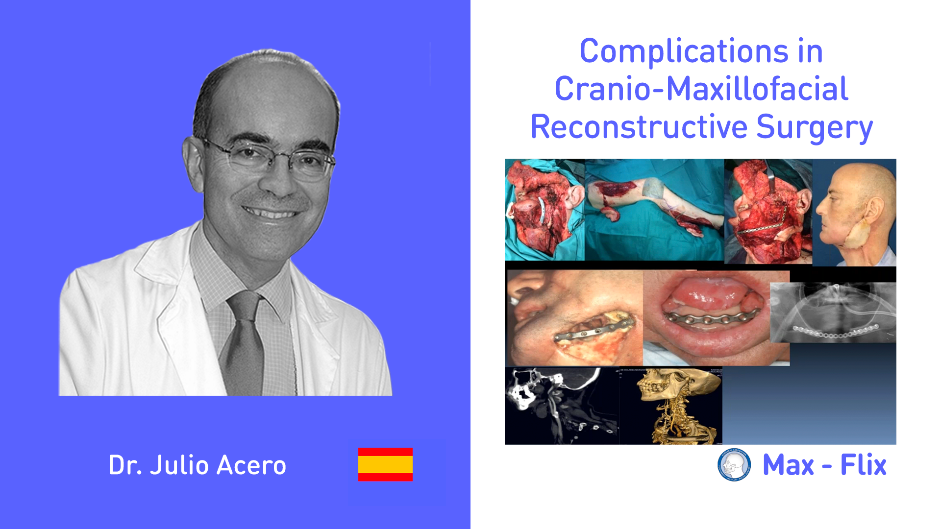 Complications in Cranio-Maxillofacial Reconstructive Surgery