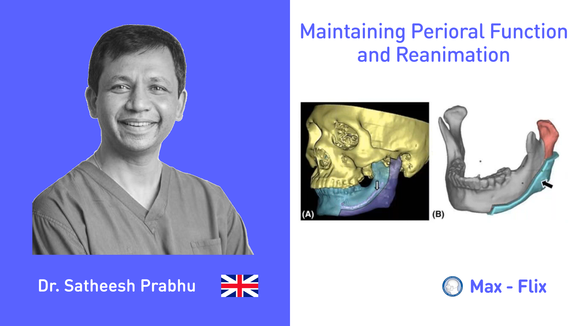 Maintaining Perioral Function and Reanimation