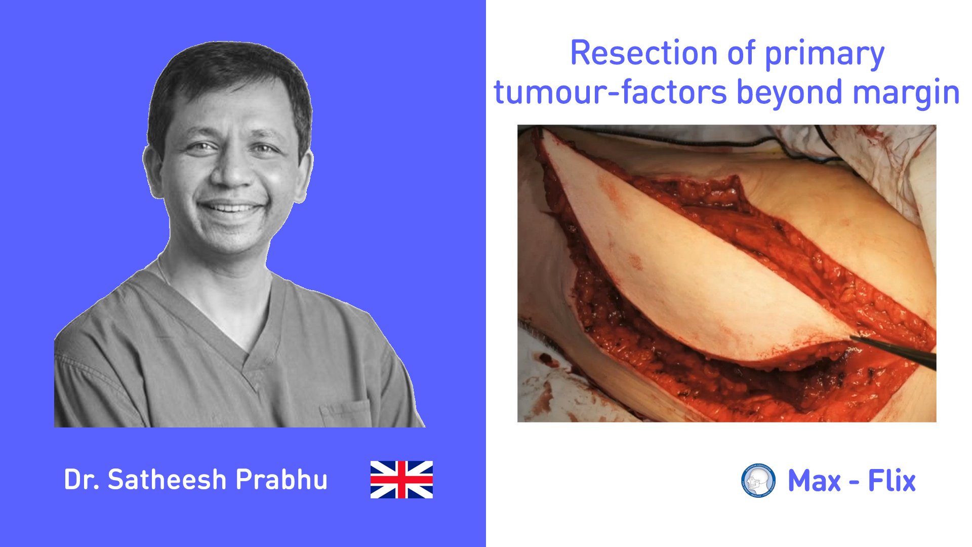 Resection of primary tumour-factors beyond margin