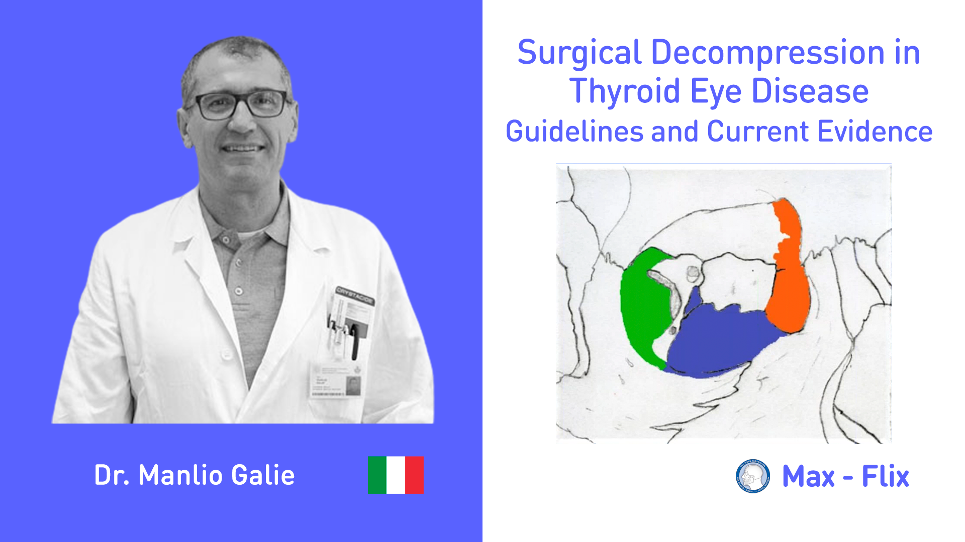 Surgical Decompression in Thyroid Eye Disease