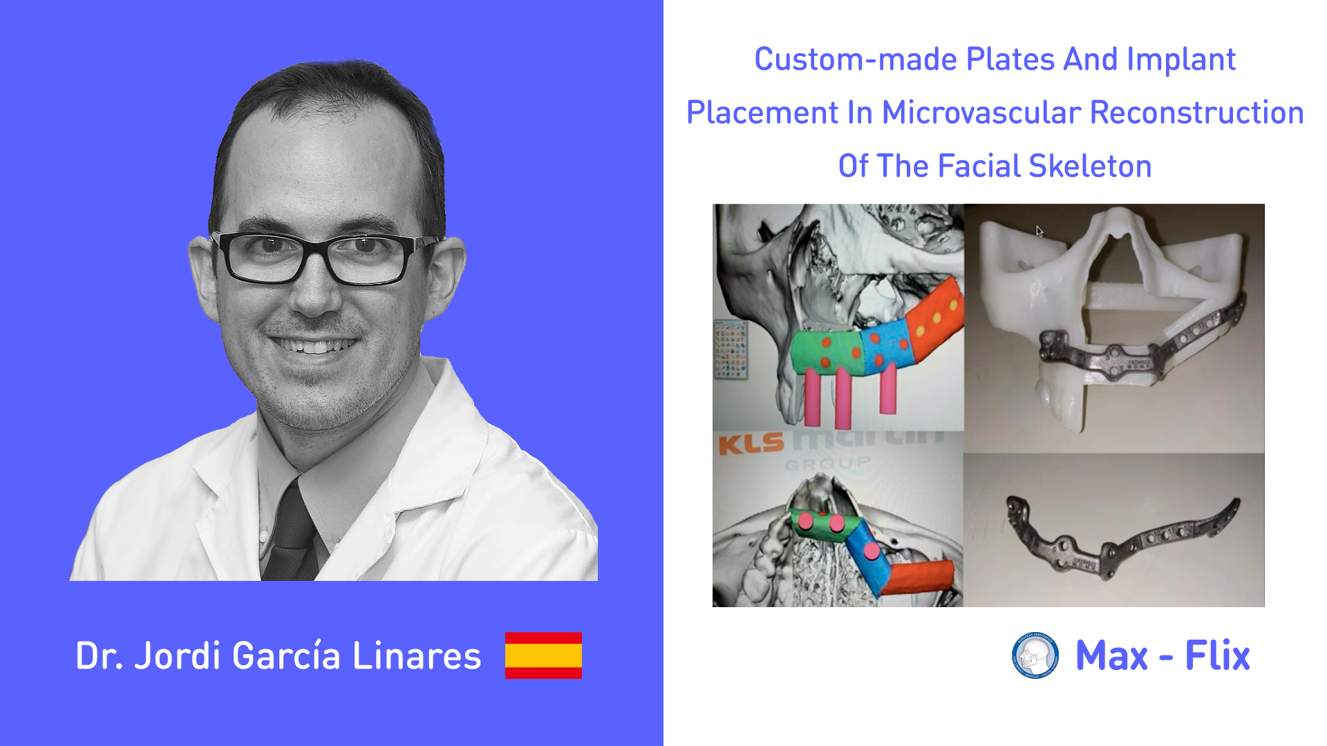 Custom-made plates and implant placement in microvascular reconstruction of the facial skeleton